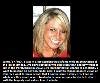 "Jamie," runner-amputee