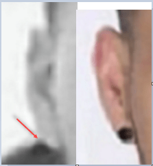 Ear Comparison 2